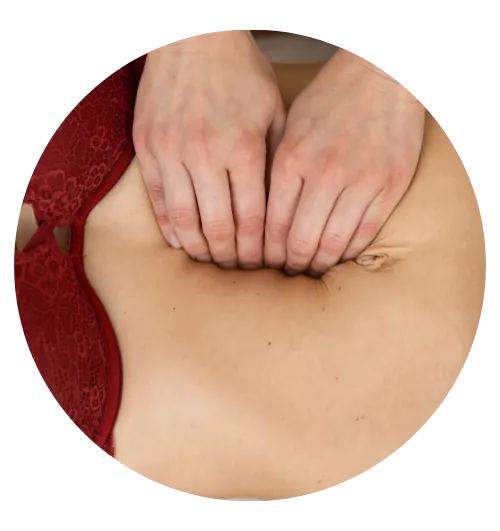 Diastasis Rekti